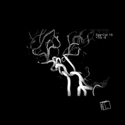 Click on the Serie image to view the images of VILLANUEVA, WILLIAM A.